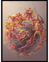 A melanoma cell viewed by an SEM using 3-D imaging method
