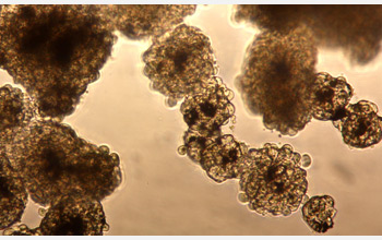 A 3-D cell culture grown with magnetic levitation.