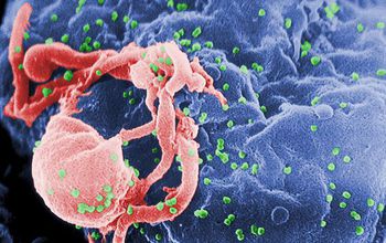 Scanning electron micrograph of HIV-1 budding from a cultured cell.