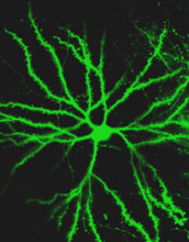 High-resolution <em>in vivo</em> image of neurons and associated dendritic spines in songbird brain