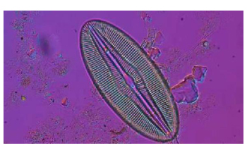 Diatom species <em>Diploneis</em>, taken from a lake sample in Greenland