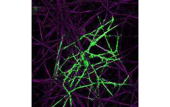 An oligodendrocyte (green), a type of glial cell