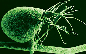 Scanning electron micrograph (with color added) of bladder of a humped bladderwort plant