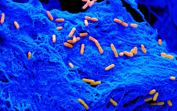 A magnification of bacteria cells (orange) on a collagen scaffold (blue)
