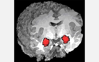3-D magnetic resonance imaging rendering of the human brain, functional MRI highlighted in red.