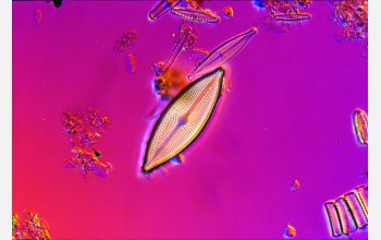 Diatom species <em>Aneumastus</em> collected for a survey of diatom flora at Hovsgol National Park in north-central Mongolia