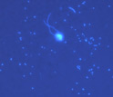Epifluorescence microscope image of bacterioplankton and a flagellate in seawater.