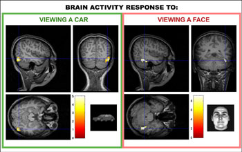 fMRI study into how learning an object recognition task "reprograms" the brain