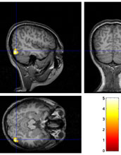 Brain region where researchers found a learning effect for subjects trained to recognize car images