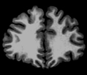 MRI scan of a 24 year-old male human brain.