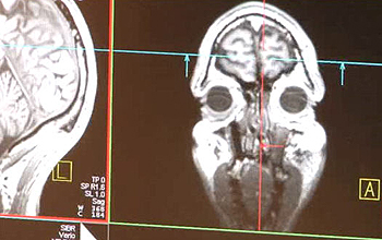 brain scan from front and side