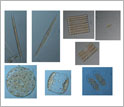 Micrographs of diatoms found near Antarctica.