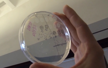 Hand holding up a Petri dish