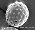 Scanning electron image of saltbush pollen.