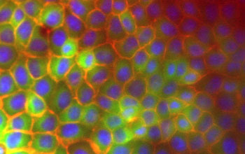 Photo of stained epithelial cells.