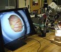 a robotic tool being developed to assist with eye surgery.
