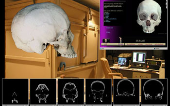 montage of images of UTCT Facility, views of human skull specimen, eSkeletons screen captures