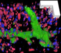 microscopic image of a mouse brain tissue