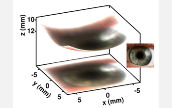 Photo showing the actual image of an eye obtained with the new 256-pixel electronic eye camera.