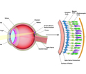 schematic of an eye and implant