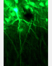 Photo of neurons within a rodent amygdala labeled with green fluorescence.
