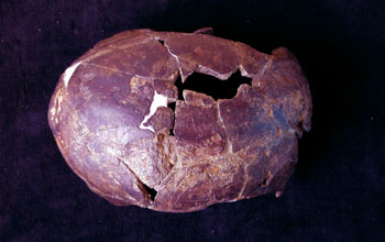 Superior view of the Omo II cranium found near the town of Kibish, Ethiopia.