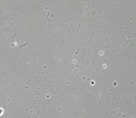 Video showing H. pylori bacterium moving freely in a higher pH mucin solution.