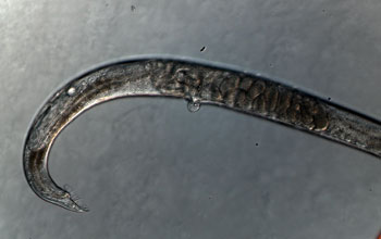 Photo of an intersex C. elegans worm carrying eggs.