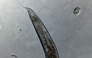 Photo of a C. elegans worm tail belonging to a hermaphrodite.