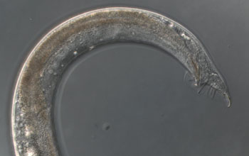 Photo of a C. elegans worm tail belonging to a male, showing sensory rays.