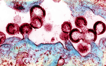 HIV virions budding and releasing from an infected cell.