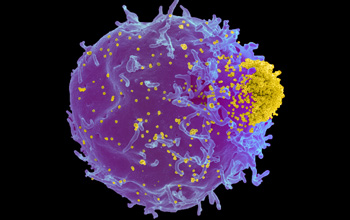 a friend mouse leukemia virus, yellow, budding from infected T-lymphocyte, blue.