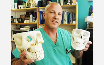Photo of surgeon Jon Wagner holding plastic casts of fractured jaws.