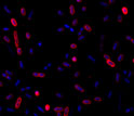 Microscopic image showing newly discovered bacterial strain; cell walls are red, DNA is blue.