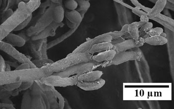 A scanning electron micrograph of fungus Nodulisporium sp.