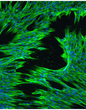 Pictures depict how cells within the heart valve can be regulated