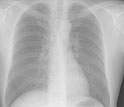 chest x-ray