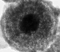 Transmission electron micrograph showing nanoparticles from the Pacific's Kilo Moana vent.