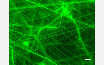Epifluorescent microscope image of salp filtering mesh.