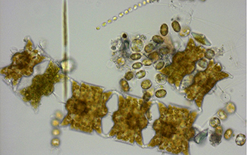 Photo of a mix of plankton in a water sample.