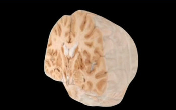 Partial brain illustration