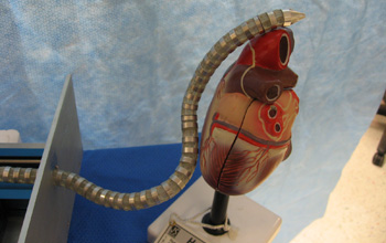 a snake robot that seeks out and removes damaged tissue in a heart.