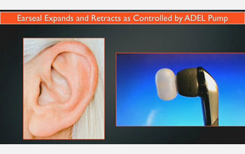 Images of an ear on the left and the Ambrose Diaphonic Ear Lens on the right.