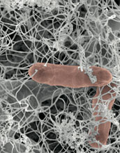 Scanning electron micrograph of bacteria, red, in initial stages of biofilm formation.