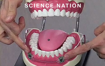 Photo of a model of an open mouth with tongue driver system components