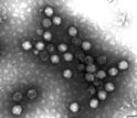 Transmission electron micrograph showing adenoviruses.
