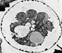 Transmission electron micrograph showing a cross-section of a spore of Cryptosporidium.