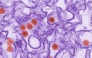 Transmission electron micrograph (TEM) of the Zika virus.