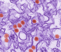 Transmission electron micrograph (TEM) of the Zika virus.