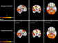 different images of the brain